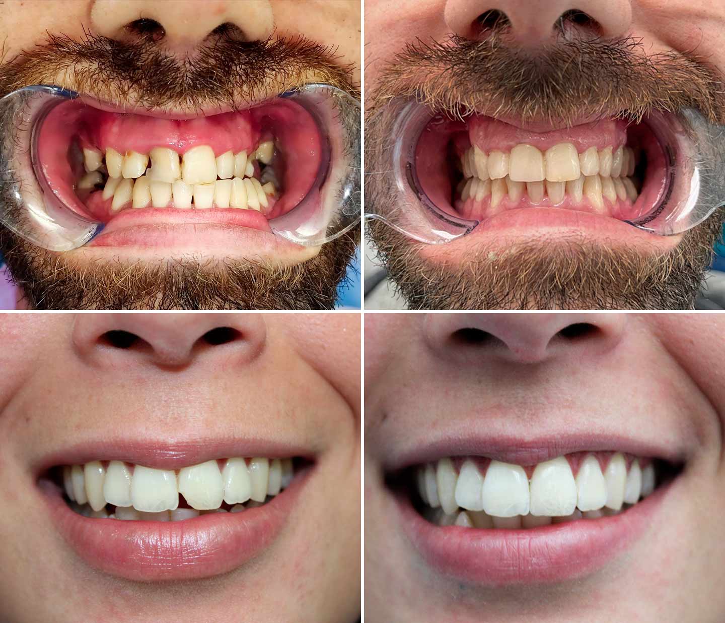 Odontoiatria conservativa e endodonzia